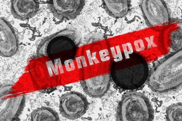 Велика Британија би можела да остане без вакцини против мајмунски сипаници на крајот на месецот
