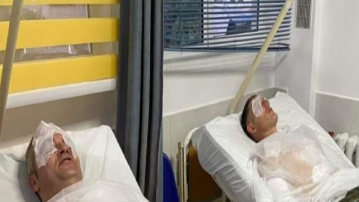 Инцидент кај фабрика за оружје во Албанија, уапсени три лица со руски и украински пасоши