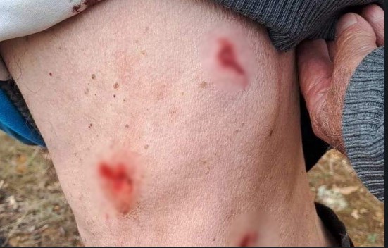 Мечка нападна човек во Македонски брод