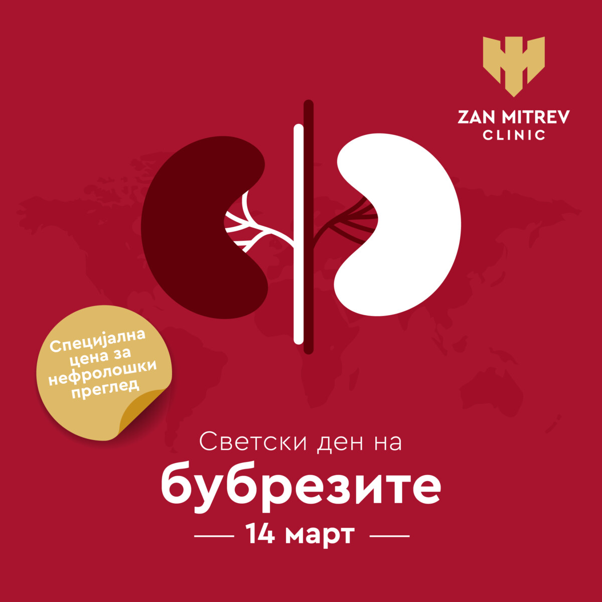 Клиника Жан Митрев се залага за еднакво бубрежно здравје за сите