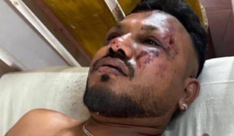 ВИДЕО Прва снимка од преживеаниот во авионската несреќа во Индија: „Сè се случи толку брзо“