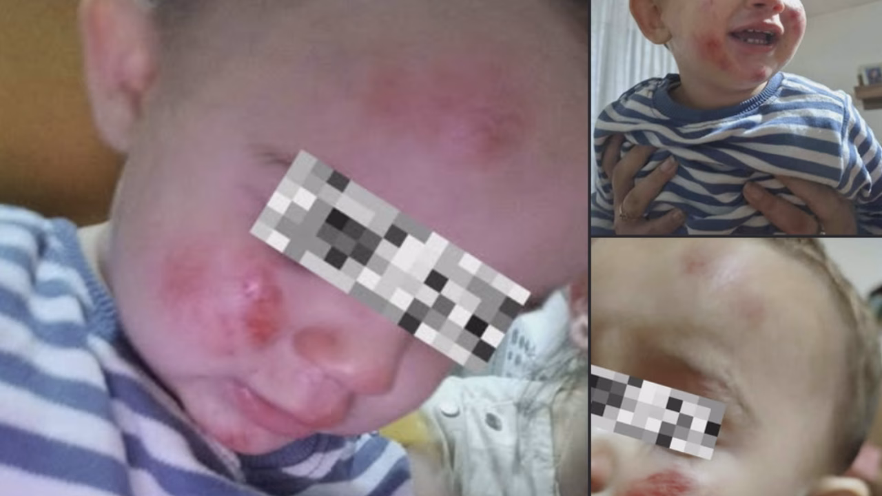 Хорор во кичевско Другово: Ротвајлери нападнале мајка со две малолетни деца!