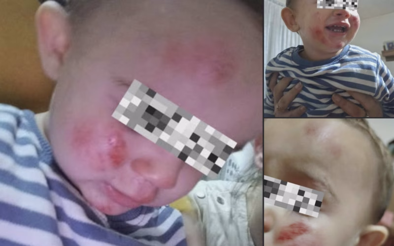Хорор во кичевско Другово: Ротвајлери нападнале мајка со две малолетни деца!